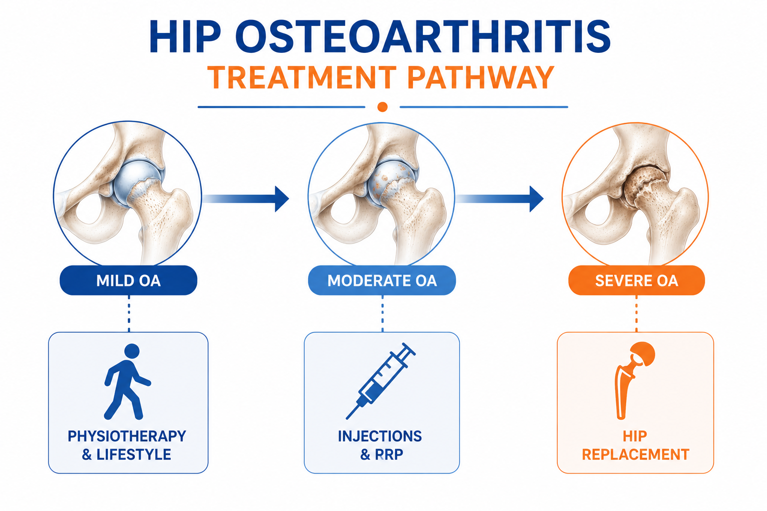 Hip osteoarthritis treatment pathway from non-surgical to surgical options