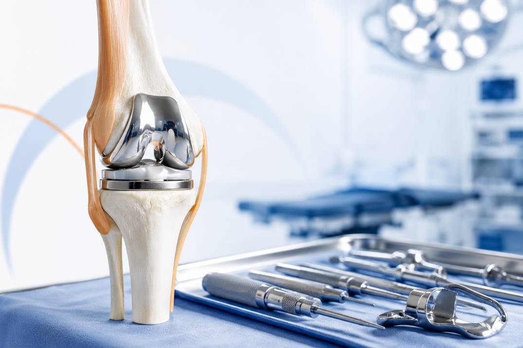 Periprosthetic joint infection treatment in Gurgaon