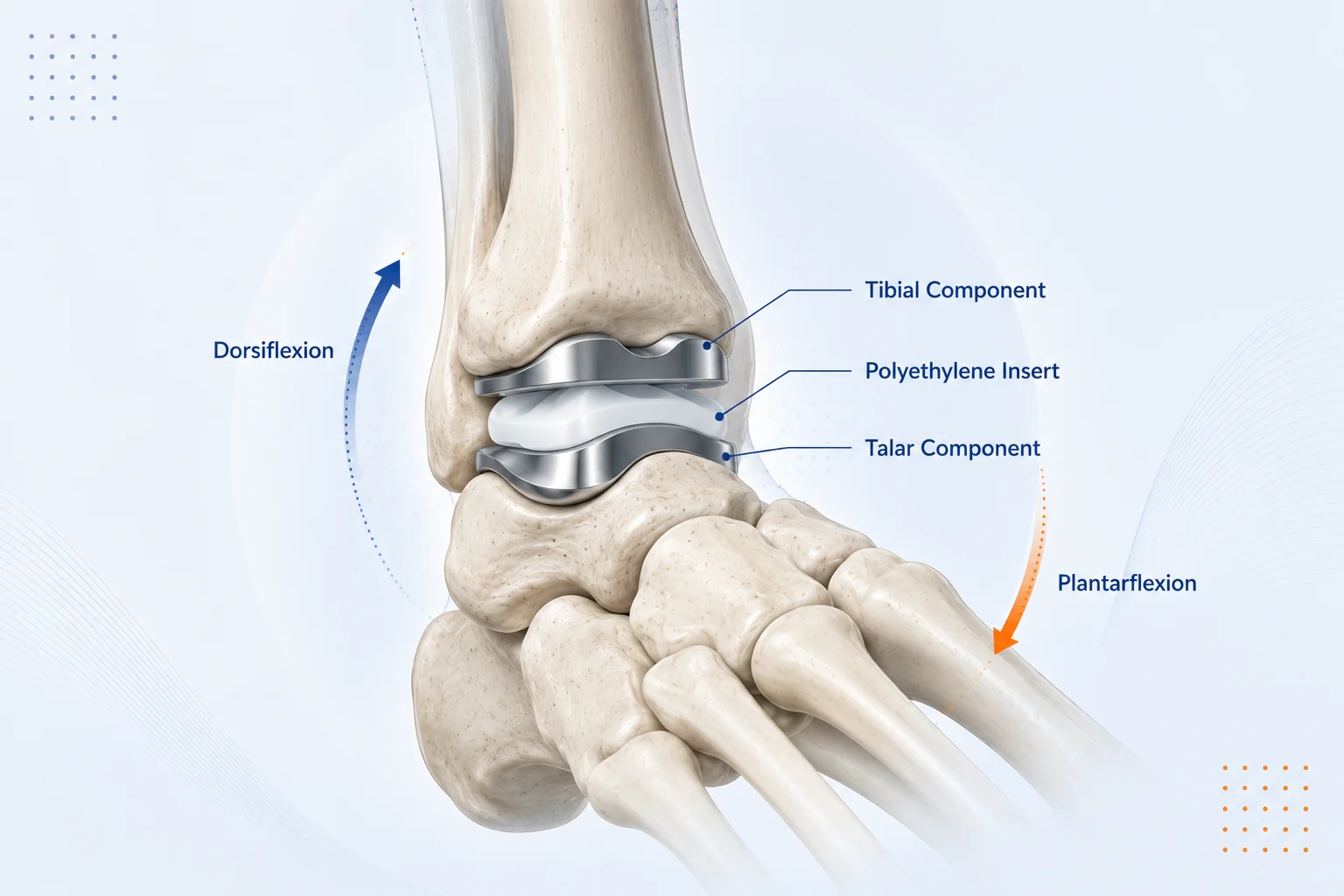 Ankle Replacement Surgery on Gurgaon. Best Ankle replacement Surgeon in Gurgaon