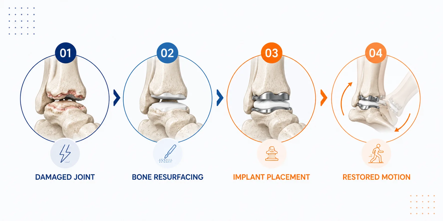 Ankle Replacement Surgery in Delhi NCR. Best Orthopedic surgeon in Delhi NCR