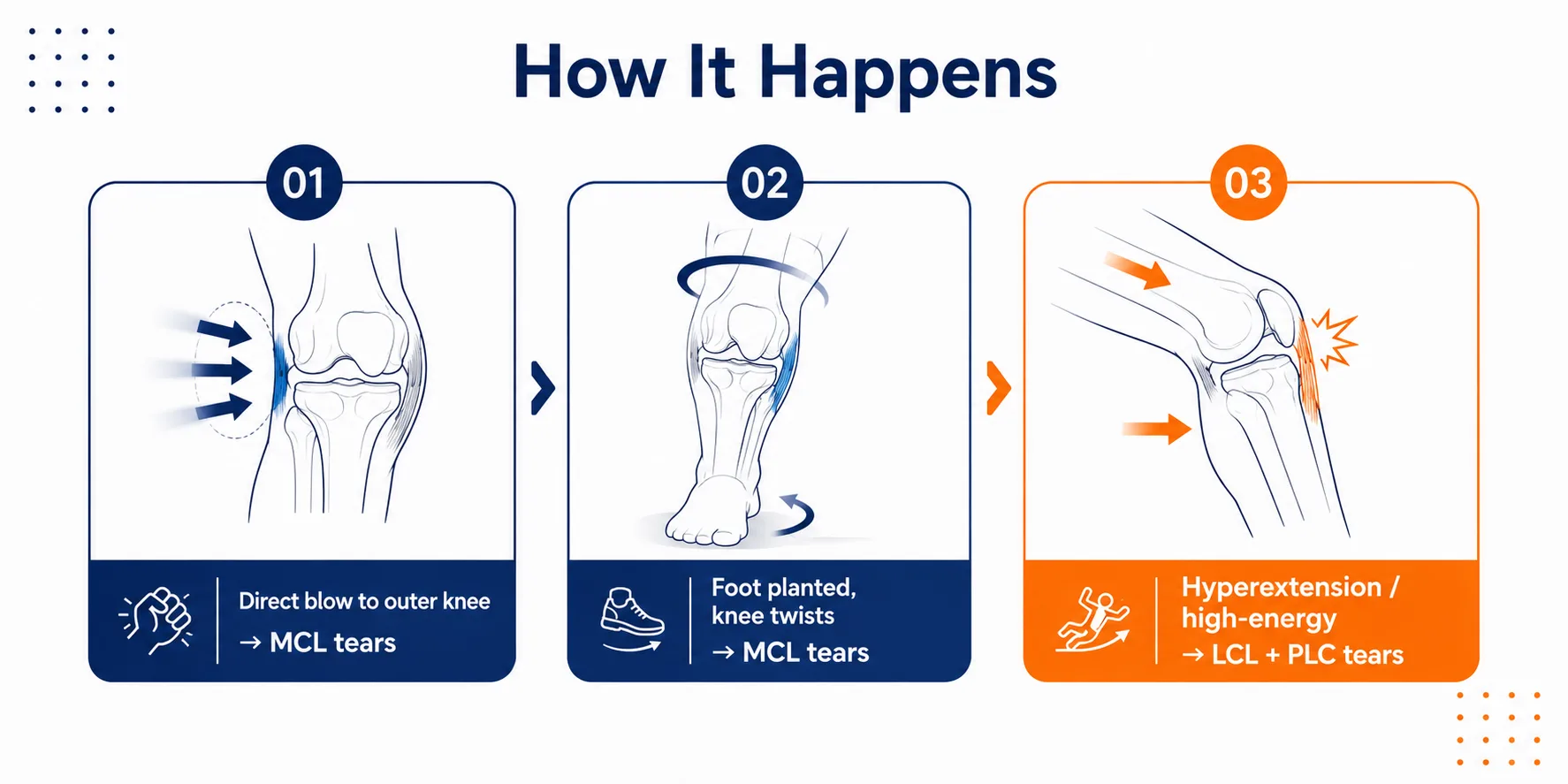 How injuries to MCL and LCL happens