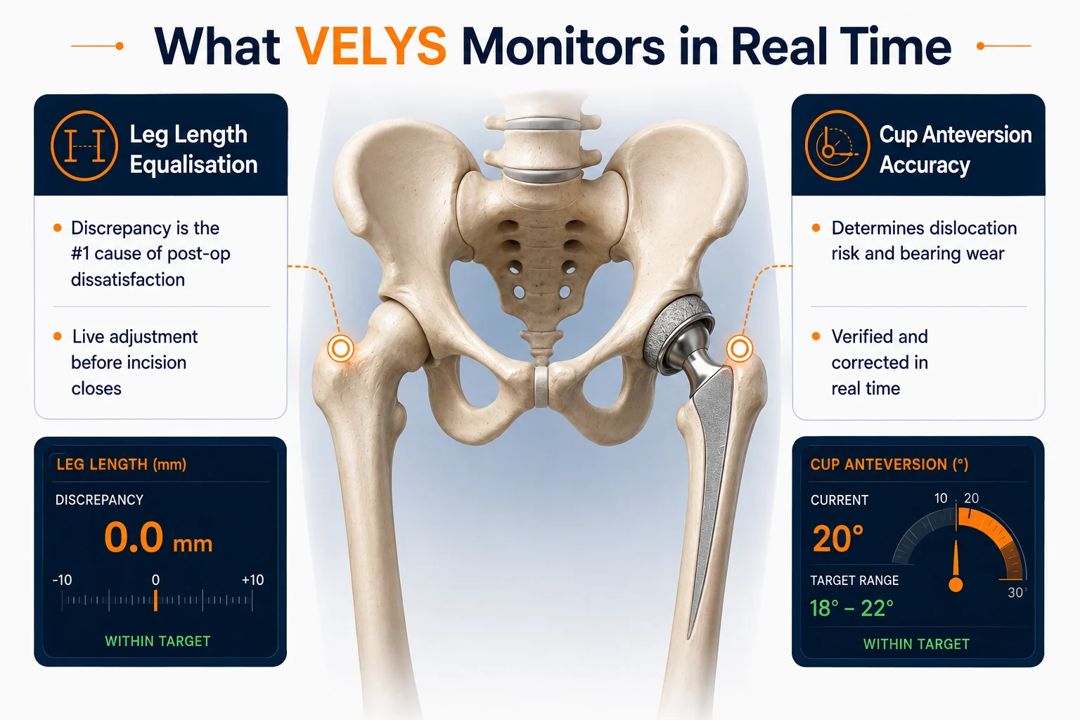 Velys System infofraphic and what velys system monitors