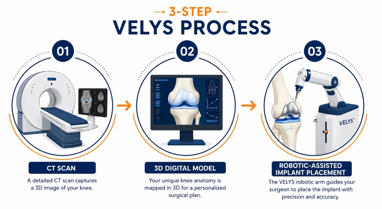 Three-step VELYS robotic-assisted knee replacement process