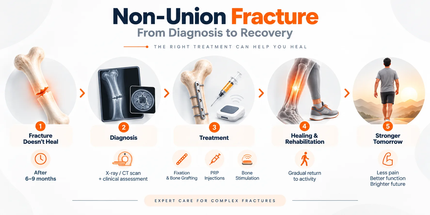 Non-union fracture treatment infographic showing diagnosis, fixation, bone grafting, PRP, bone stimulation and rehabilitation.