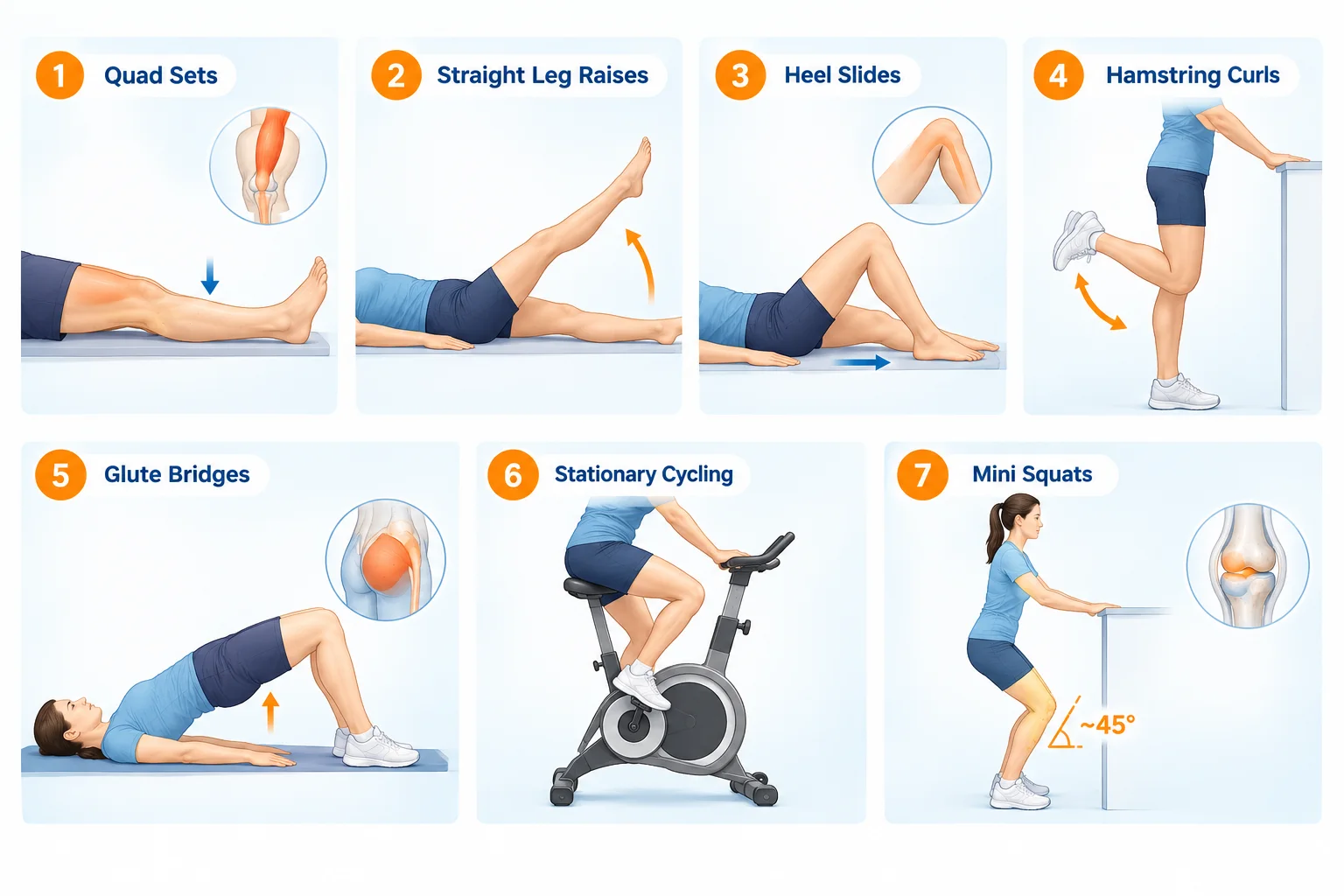Medical infographic showing seven meniscus tear rehabilitation exercises: quad sets, straight leg raises, heel slides, hamstring curls, glute bridges, stationary cycling and mini squats with a 45-degree knee bend.